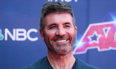 Simon Cowell Plastic Surgery