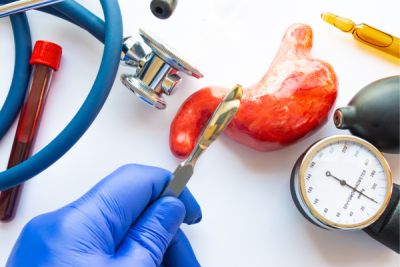 What Does Sleeve Surgery Do?
