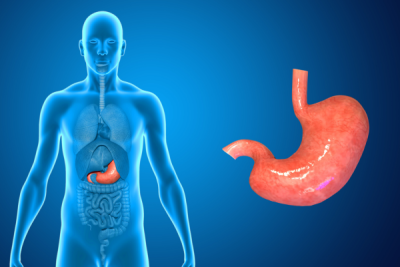What Does Endoscopic Weight Loss Treatment Do?