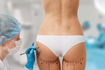 Brazilian Butt Lift Surgery: Who's a Suitable Candidate?