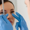 Nose Surgery