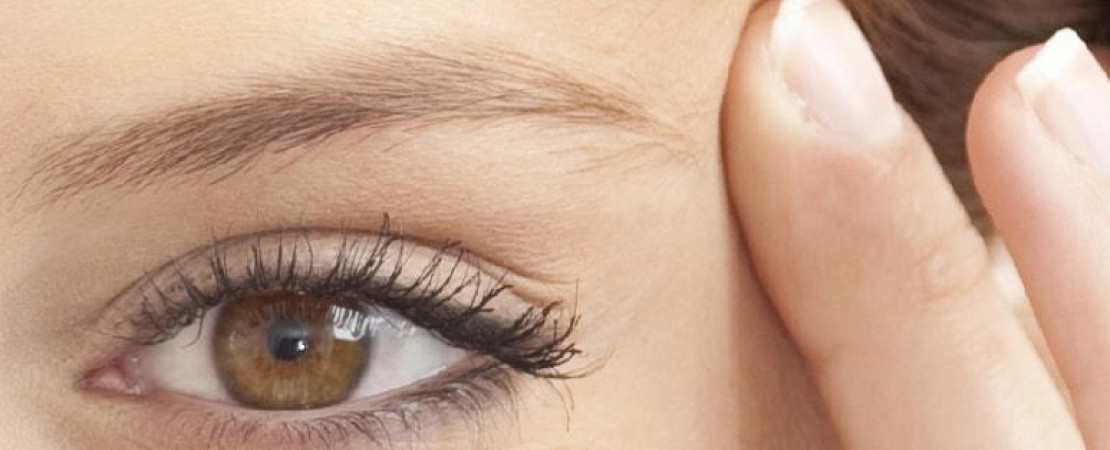 Lateral Brow Lift