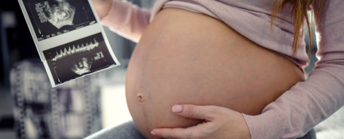 IVF Treatment