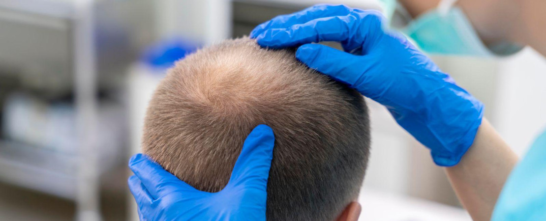 DHI Hair Transplant