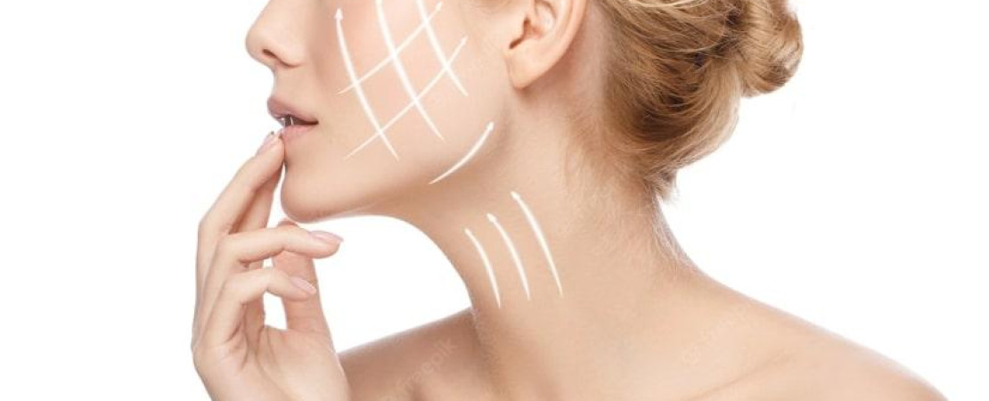 Neck Lift / Plastysmaplasty 