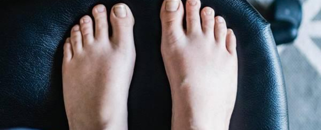 Toe Shortening