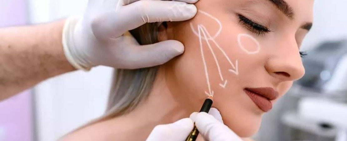 Dermal Fillers