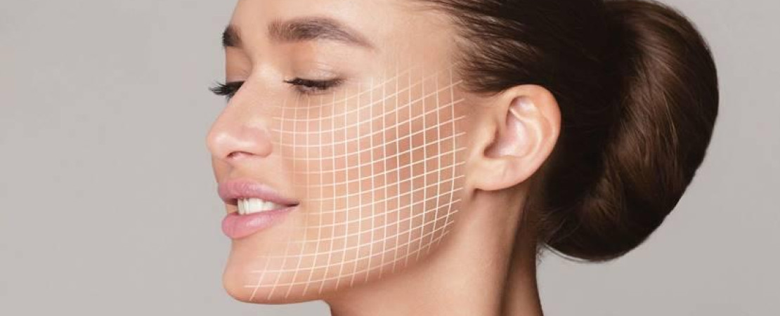 Chin Implants