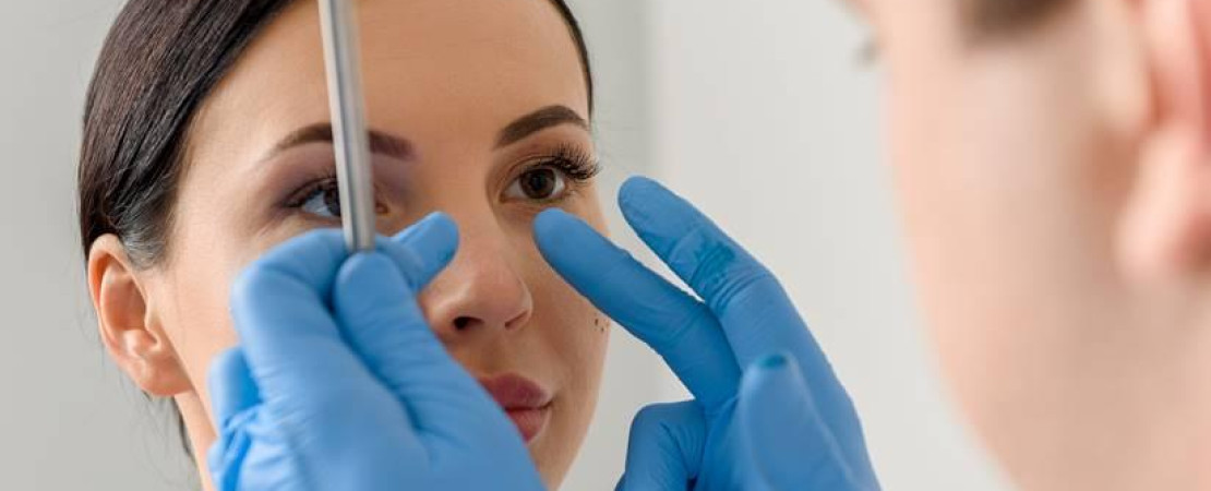 Nose Surgery
