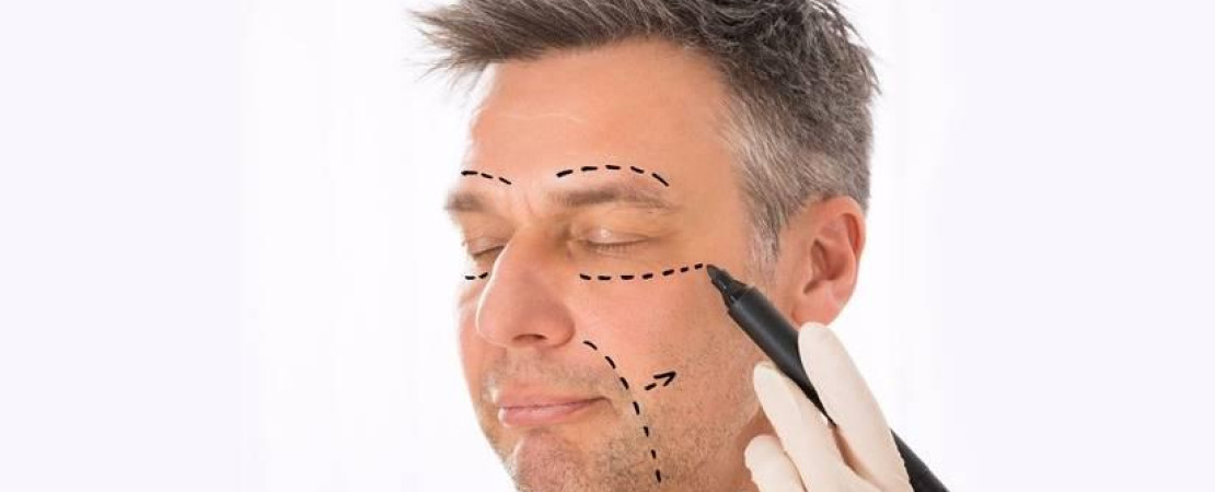 Male Cheek Implant