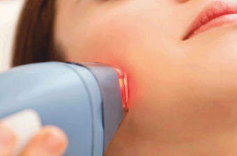 Laser Skin Resurfacing