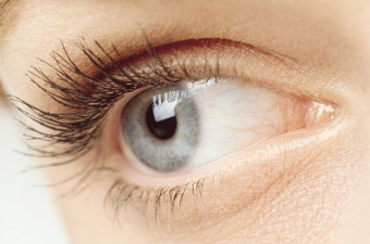 Upper Eyelid Removal