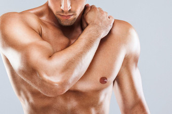 Chest Masculinization Surgery