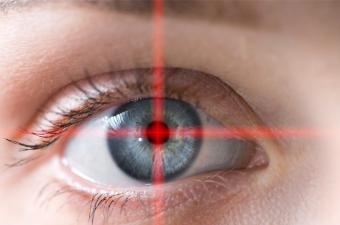 Intralase Laser Eye Correction