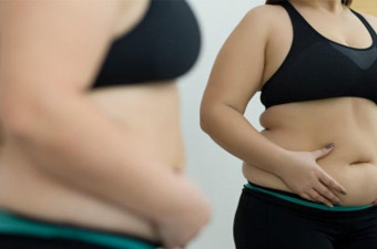 Gastric Bypass