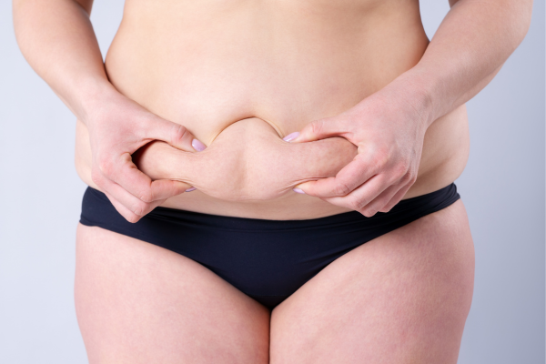 Tummy Tuck Surgery Guide