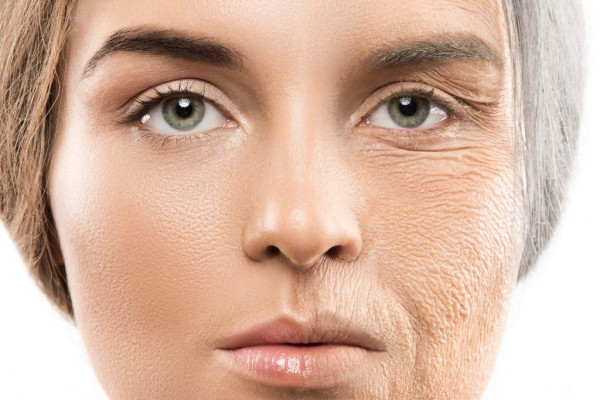 Face Lift Surgery