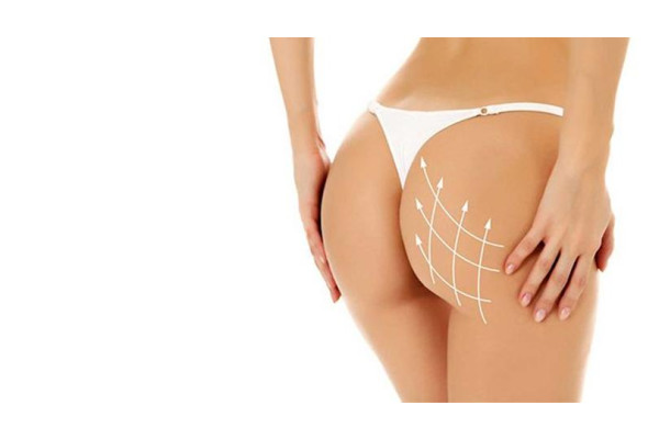What is the Difference Between Brazilian Butt Lift Surgery and Other Buttock Enhancement Procedures?