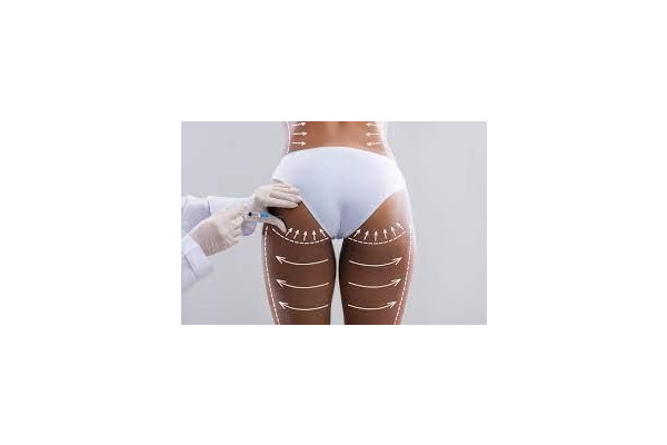 Will there be any visible scars after Brazilian butt lift surgery?