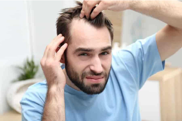 What Are the Different Hair Transplant Techniques?