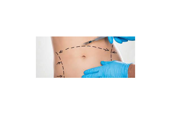 Choosing the Right Body Procedure: Tummy Tuck vs. Liposuction
